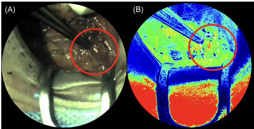 A pilot feasibility study to assess vascularity and perfusion of parathyroid glands using a portable hand‐held imager